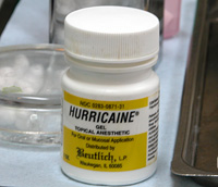 表面麻酔( 薬剤の塗布 )